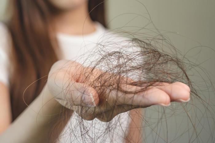 Tips for Overcoming Hair Loss with Natural Ingredients